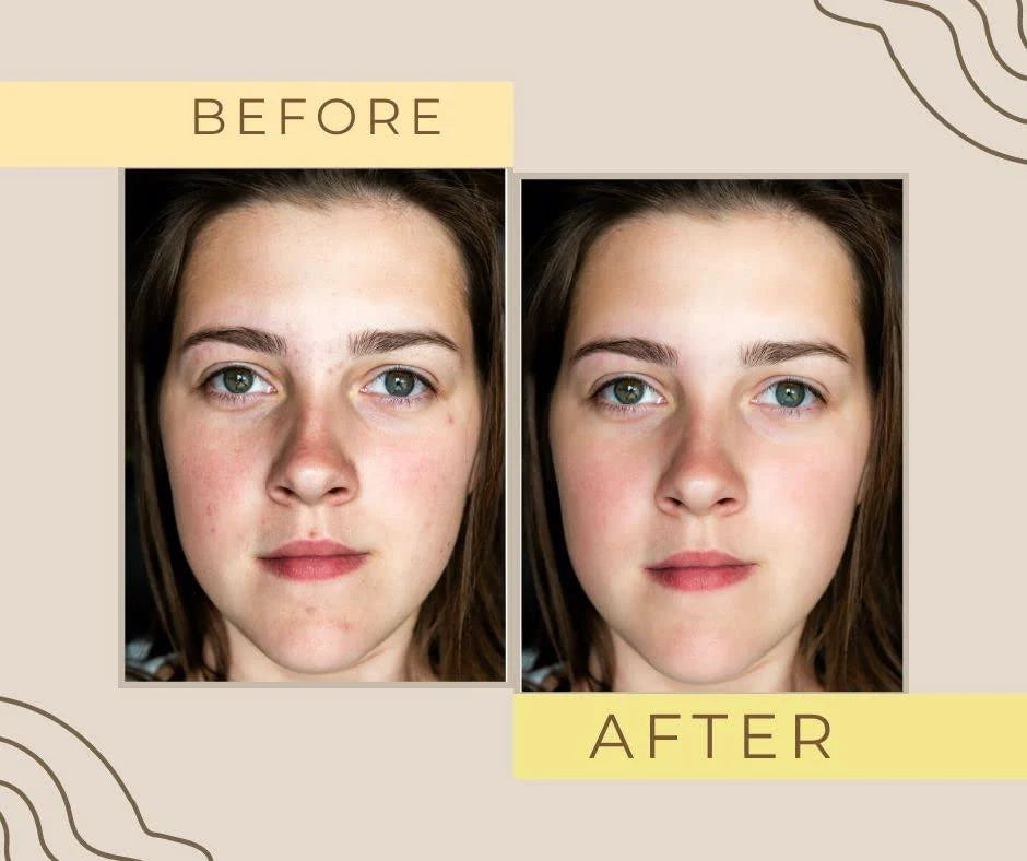 Glow & White Korean Whitening Gold Cream